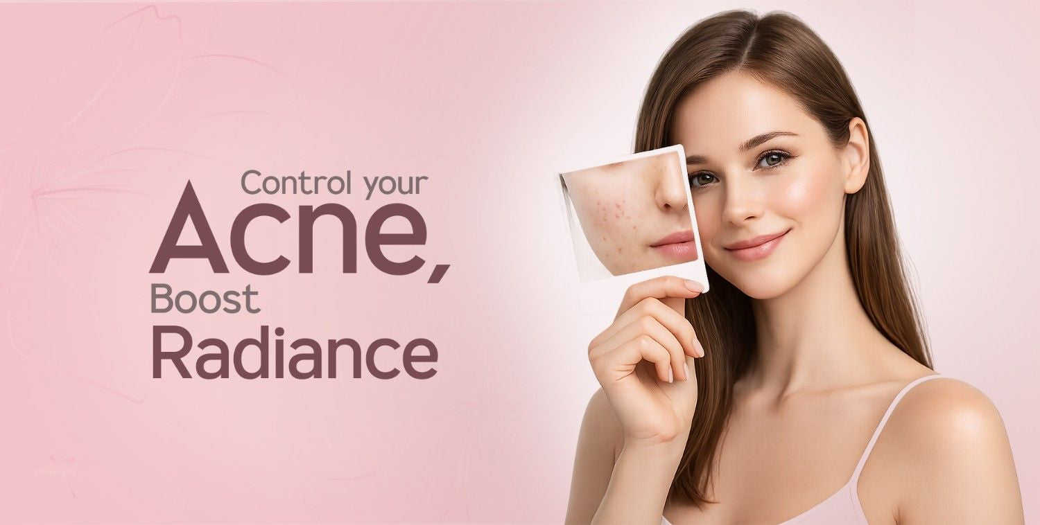 Smiling woman holding a photo of acne-prone skin, showcasing a clear complexion.
