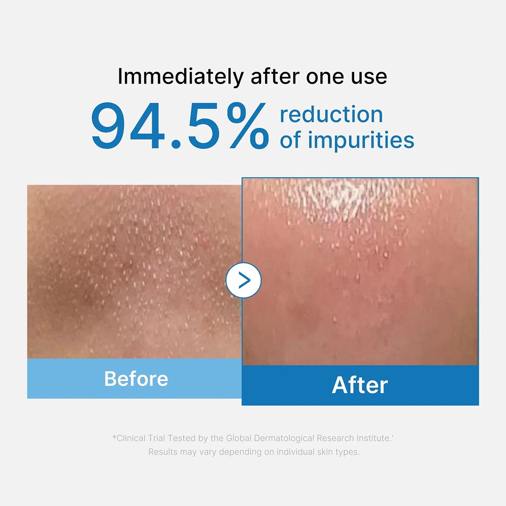 Medicube Pore Blackhead Deep Cleansing Oil 205ml-Cleansing Oil-Aladin Beauty