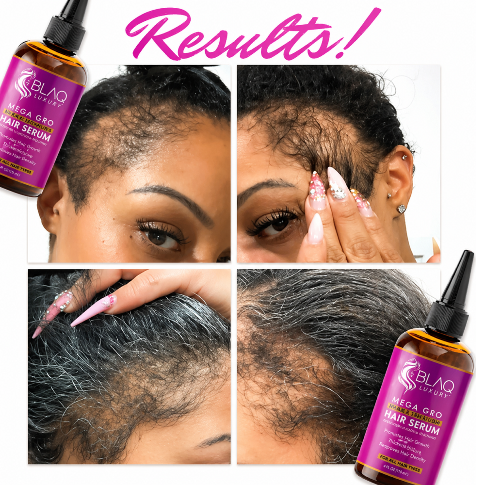 Blaq Mega Gro Hair Serum-All-Aladin Beauty